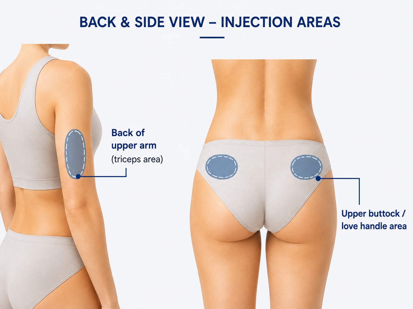 Back and side view diagram showing peptide injection areas including back of upper arm and upper buttock or love-handle area